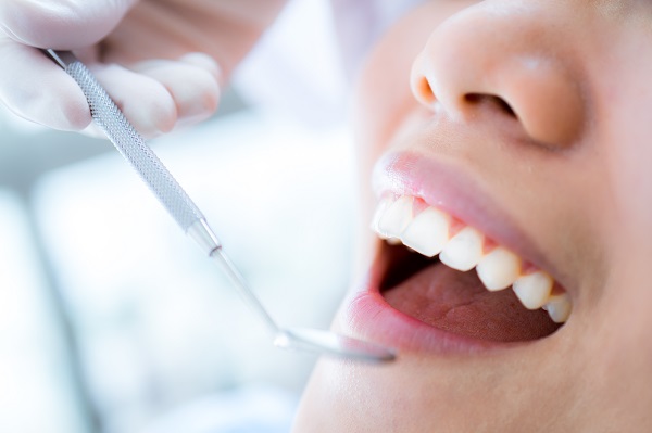 How Dental Sealants Can Help A Damaged Tooth