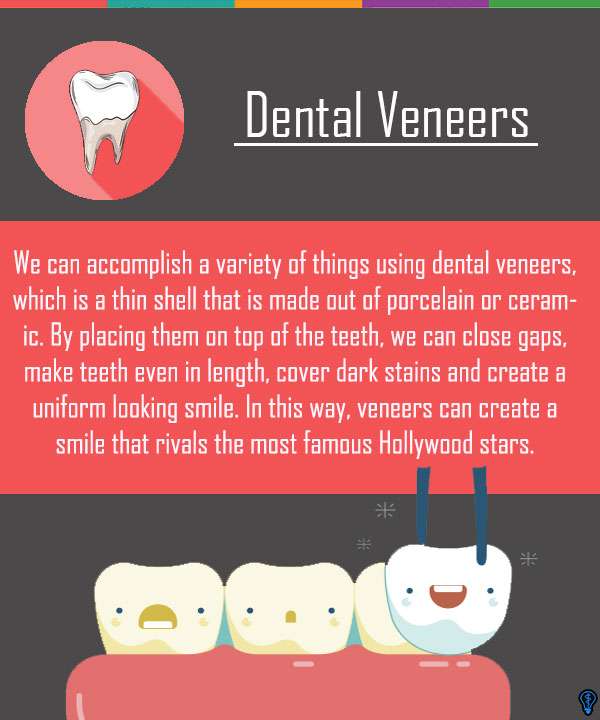 Dental Veneers and Dental Laminates Miami Beach, FL