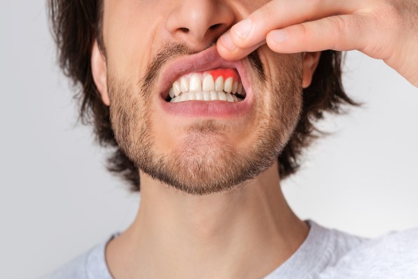 Tooth Pain From Gum Disease