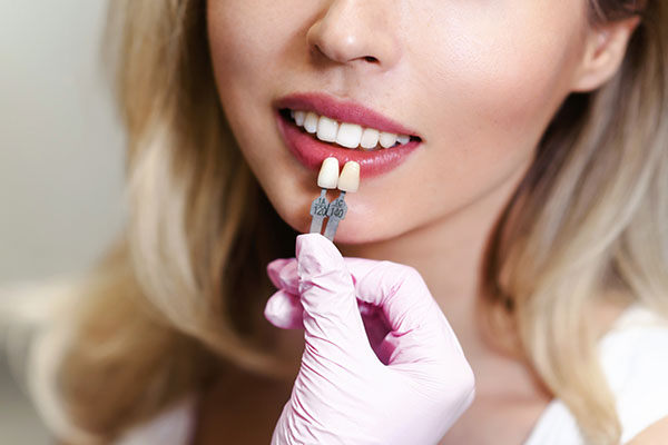How Effective Are Dental Veneers? from Miami Beach Smiles in Miami Beach, FL