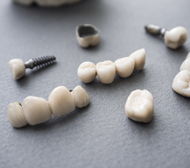 Miami Beach The Difference Between Dental Implants and Mini Dental Implants